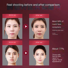 Facial Slimming Device for Chin and Jawline Contouring